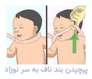 پیچیدن بند ناف به سر نوزاد باعث خفگی می گردد.