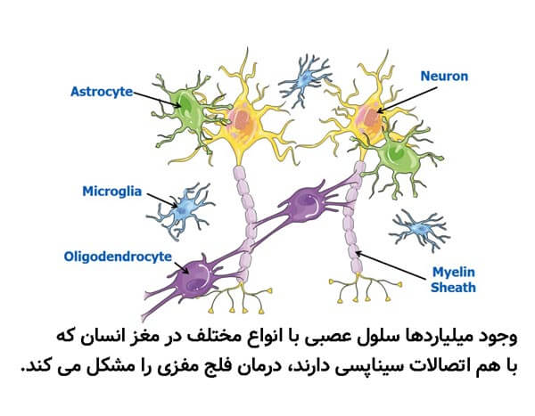 درمان فلج مغزی با سلول های بنیادی