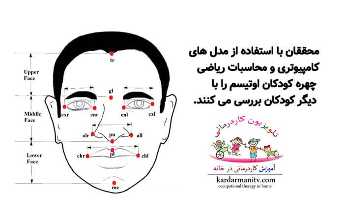 تشخیص اوتیسم از روی چهره